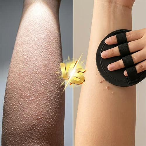 Deep Exfoliating Body Scrubber – Finger-Grip Dead Skin Remover