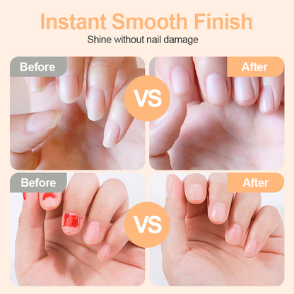 💅 2-in-1 Electric Nail Clipper & Polisher ✨ Safe, Smooth & Salon-Quality Nails at Home